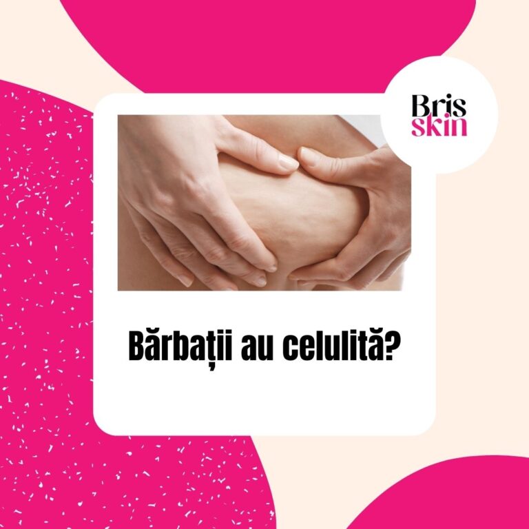 Bărbații au celulita? Adevarului despre celulita la bărbați