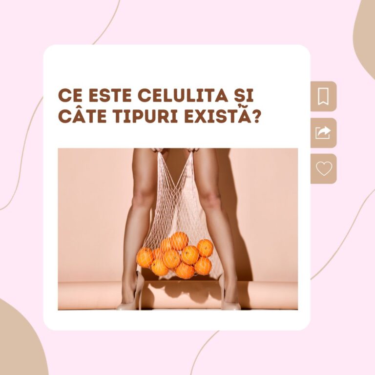 Ce este celulita și câte tipuri există?