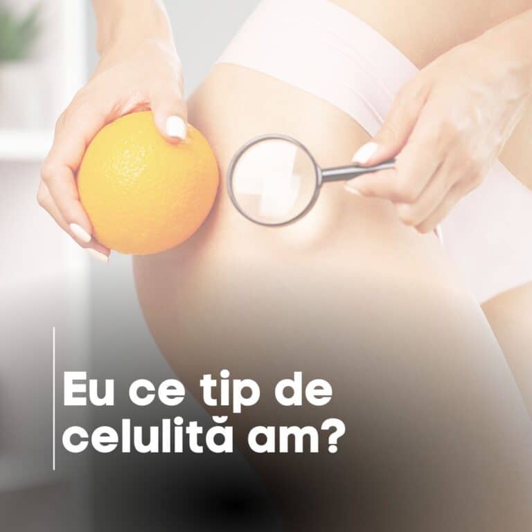 Eu ce tip de celulită am?